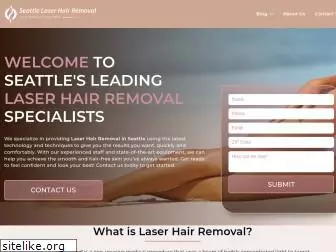 laserremovalseattle.com
