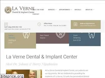 lavernedentalimplant.com