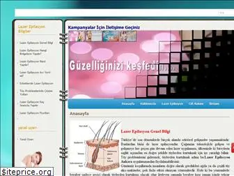 lazerepiilasyon.com