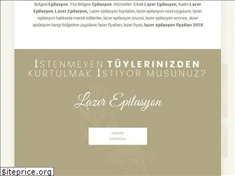 lazerepilasyonn.com