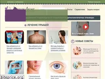 lechimacne.ru