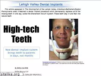 lehighvalleydentalimplants.com