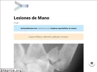 lesionesdemano.com