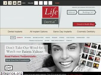 lifedentalimplants.co.uk