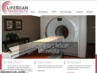 lifescanmn.com