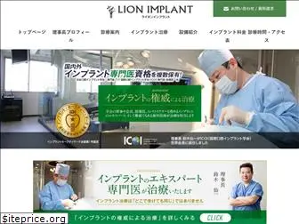 lion-implant.jp