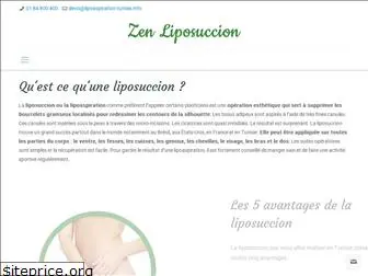 lipoaspiration-tunisie.info