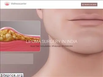 lipomasurgery.in