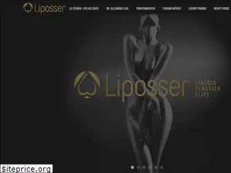 liposser.com