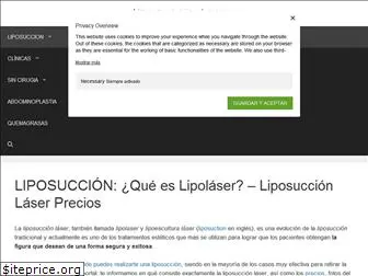 liposuccion-laser.com