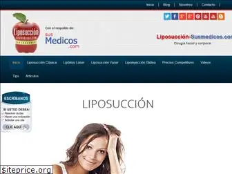 liposuccion-susmedicos.com