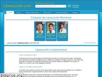 liposuccion.com