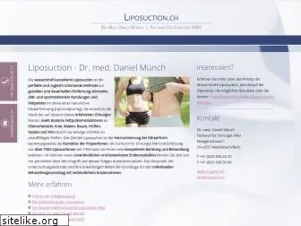 liposucction.ch