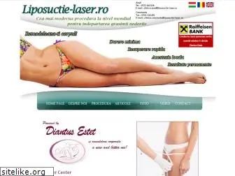 liposuctie-laser.ro