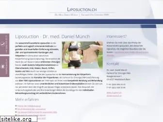 liposuction.ch