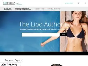 liposuction.com