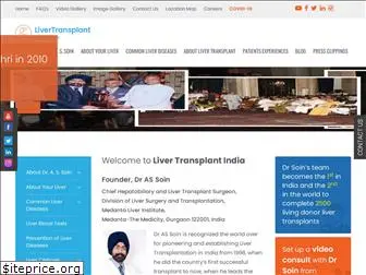 livertransplantindia.com