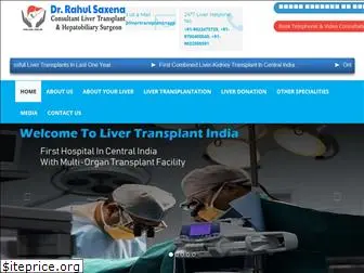 livertransplantindia.info