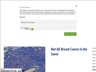 lobularbreastcancer.org
