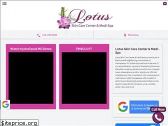 lotuslasertreatments.com