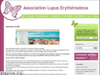 lupus-belgium.org