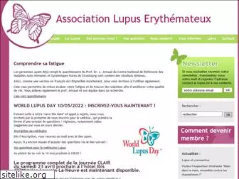 lupus.be