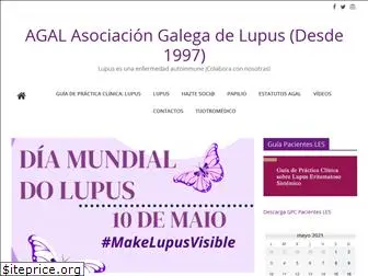 lupusgalicia.org
