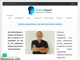 maxilofacialeimplantes.com