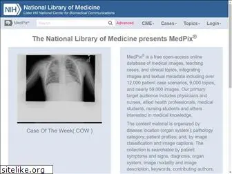 medpix.nlm.nih.gov