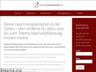 meinehaartransplantation.net