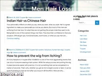 men-hairloss.com