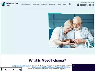 mesotheliomahope.com