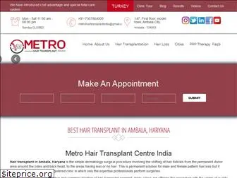 metrohairtransplantindia.com