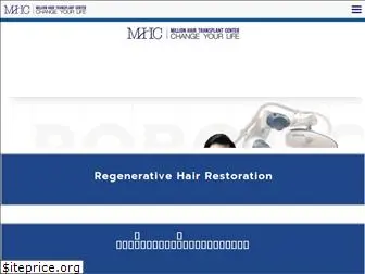 millionhairtransplant.com