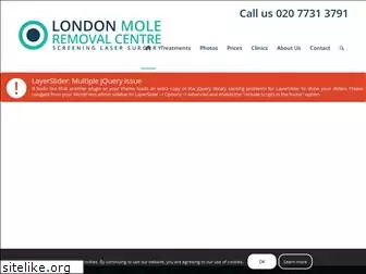 mole-removal.co.uk