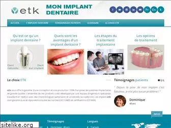 mon-implant-dentaire.fr