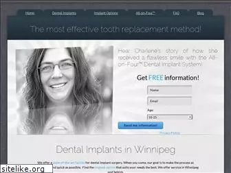 mydentalimplants.ca