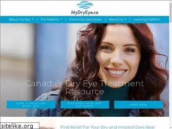 mydryeye.ca