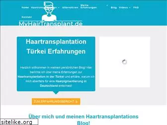 myhairtransplant.de