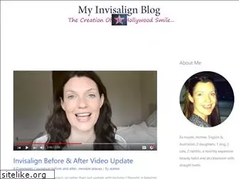 myinvisalignblog.com