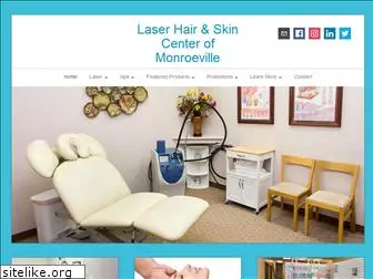 mylaserhair.com