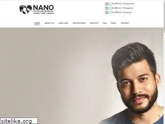 nanofolliclehairtransplant.com