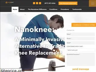 nanoknee.com