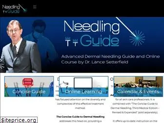 needlingguide.com