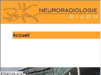 neuroradio-dijon.com