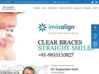 newdelhiorthodontist.com