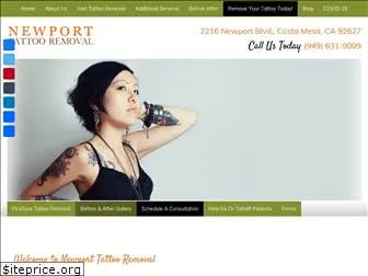 newporttattooremoval.com