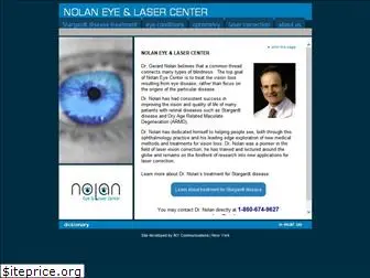 nolaneye.com