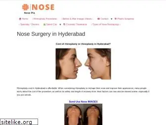 noseplasticsurgery.in