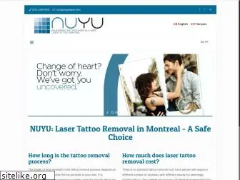 nuyulaser.com